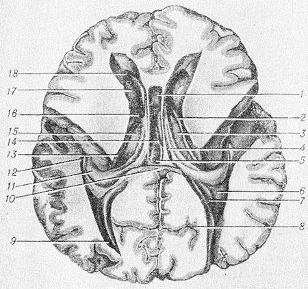 Боковые желудочки головного мозга на кт норма. Конечный мозг анатомия боковые желудочки. Боковые желудочки анатомия. Коллатеральное возвышение бокового желудочка. Коллатеральное возвышение бокового желудочка.